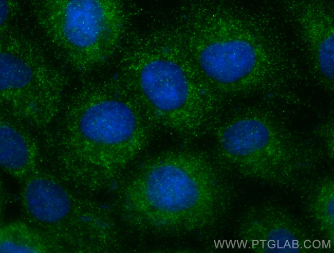 KLK7 Antibody in Immunocytochemistry (ICC/IF)