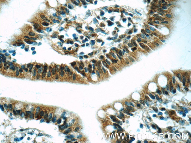 RSRC1 Antibody in Immunohistochemistry (Paraffin) (IHC (P))