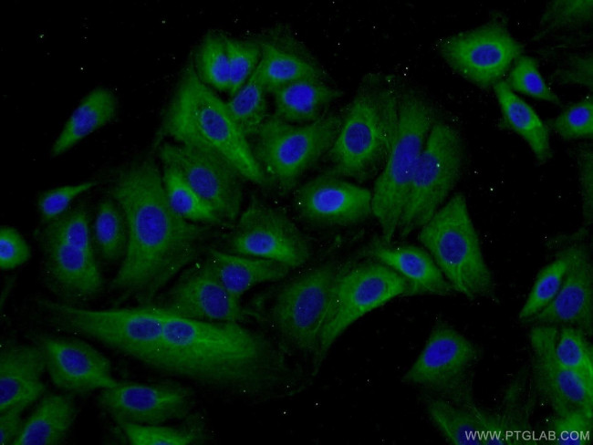 IREB2 Antibody in Immunocytochemistry (ICC/IF)