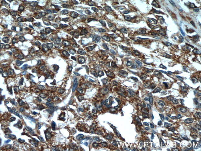 ANXA2R Antibody in Immunohistochemistry (Paraffin) (IHC (P))