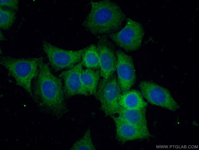 CLIP1 Antibody in Immunocytochemistry (ICC/IF)
