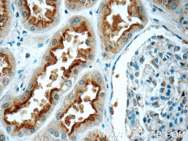 NDUFC1 Antibody in Immunohistochemistry (Paraffin) (IHC (P))