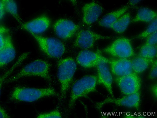 SCF Antibody in Immunocytochemistry (ICC/IF)