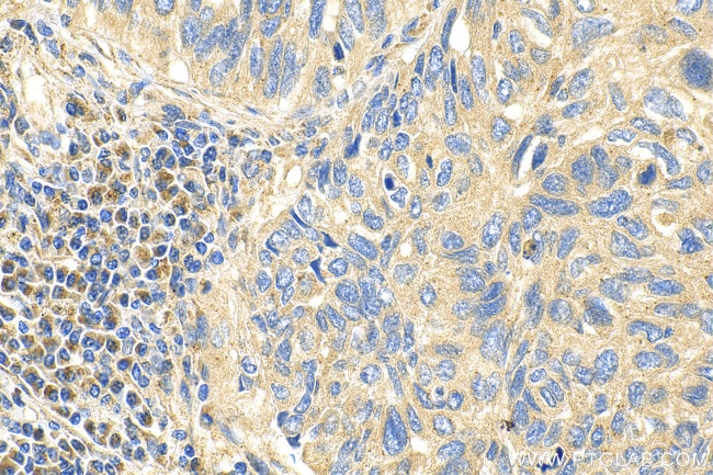 PCDHGC5 Antibody in Immunohistochemistry (Paraffin) (IHC (P))