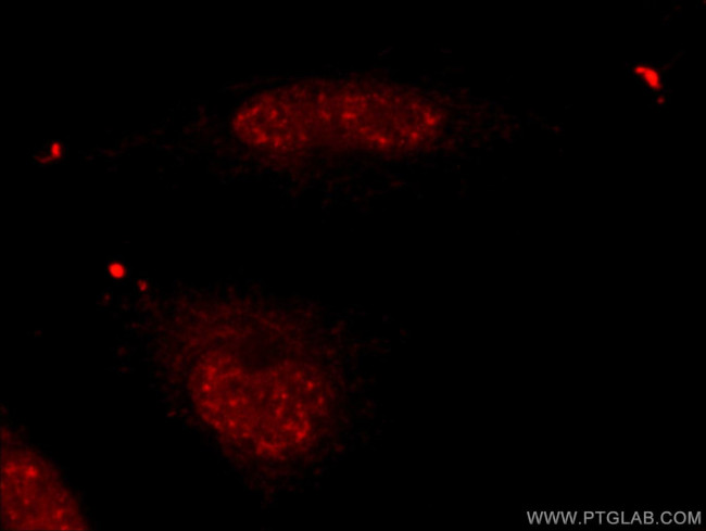 USP39 Antibody in Immunocytochemistry (ICC/IF)