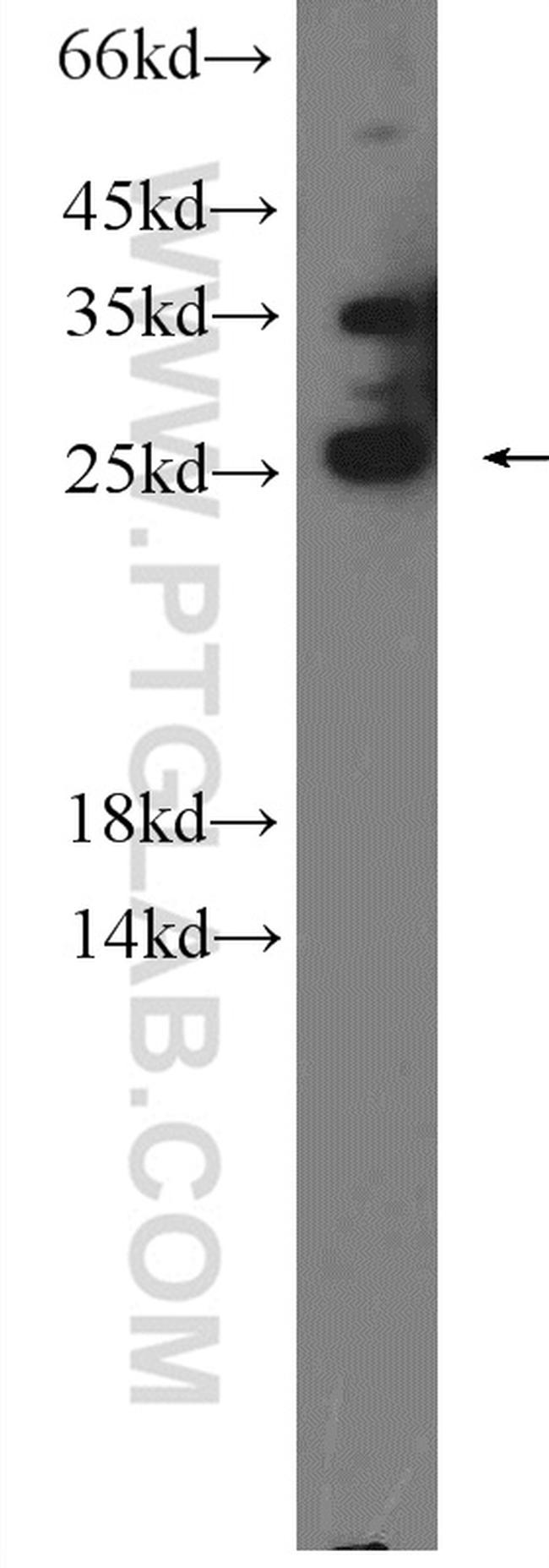 PRRX2 Antibody in Western Blot (WB)