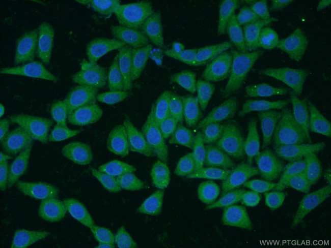 MRPL33 Antibody in Immunocytochemistry (ICC/IF)