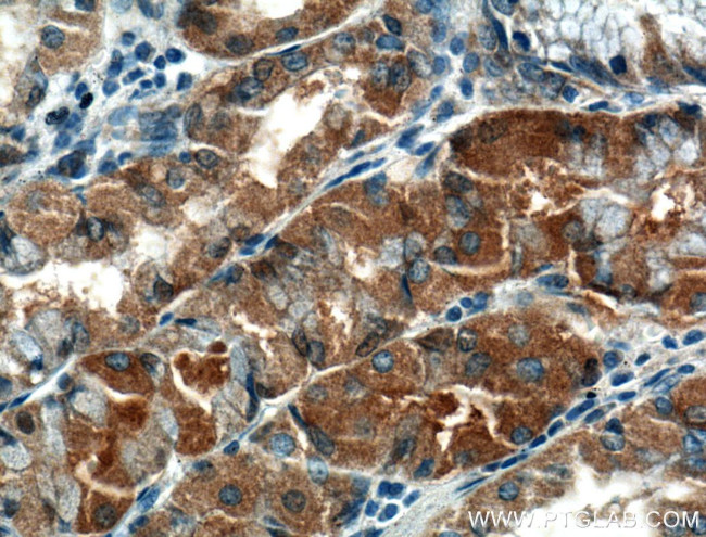 TMEM208 Antibody in Immunohistochemistry (Paraffin) (IHC (P))