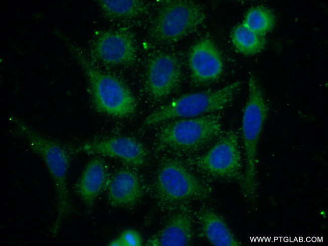 PPP2R5E Antibody in Immunocytochemistry (ICC/IF)