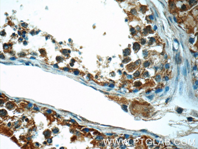 CEP55 Antibody in Immunohistochemistry (Paraffin) (IHC (P))