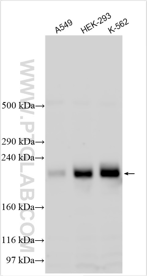 N4BP2 Antibody in Western Blot (WB)