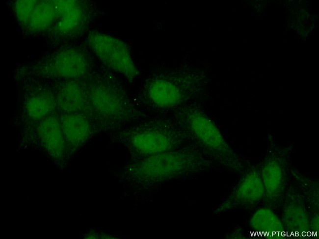 ATAD2 Antibody in Immunocytochemistry (ICC/IF)