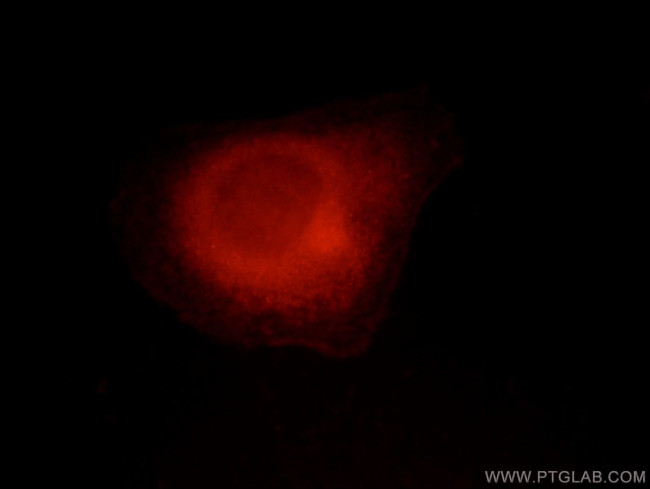 MME/CD10 Antibody in Immunocytochemistry (ICC/IF)