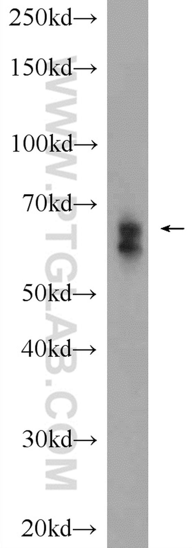 RBM47 Antibody in Western Blot (WB)