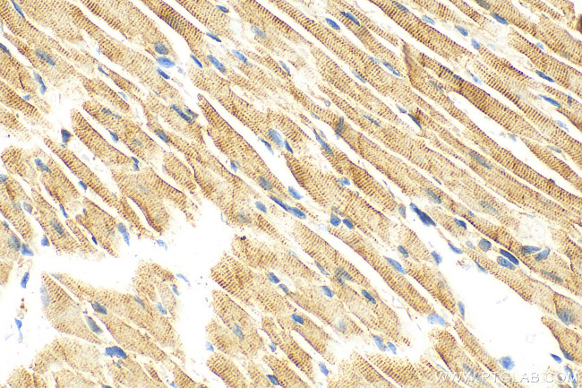 CTGF Antibody in Immunohistochemistry (Paraffin) (IHC (P))