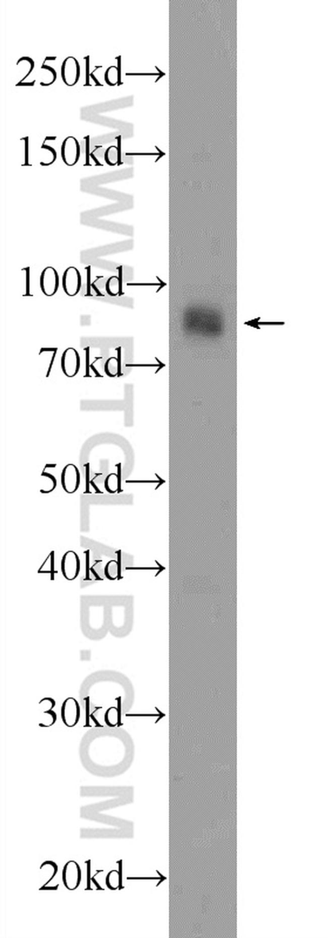 AFAP1L1 Antibody in Western Blot (WB)