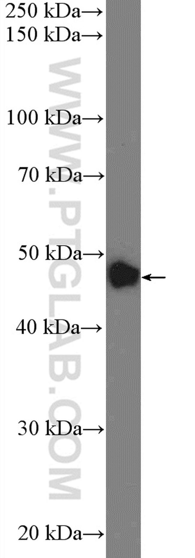 ZNF572 Antibody in Western Blot (WB)