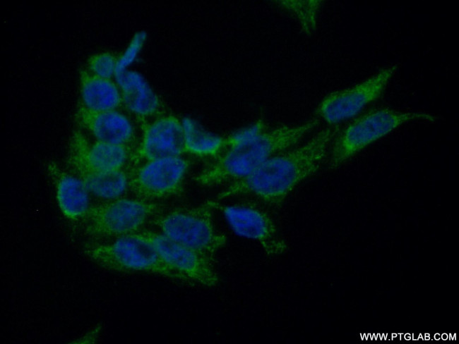 MOK Antibody in Immunocytochemistry (ICC/IF)