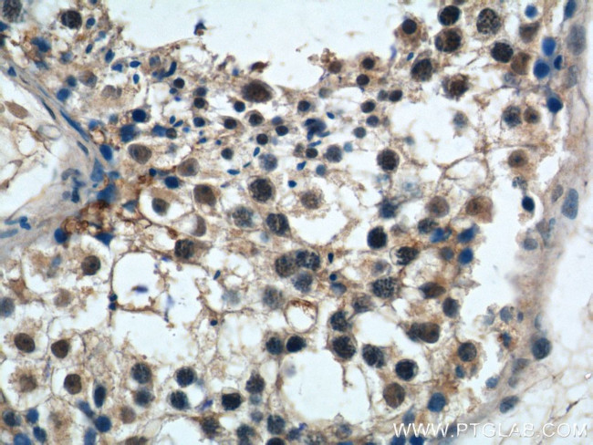 PRPF6 Antibody in Immunohistochemistry (Paraffin) (IHC (P))