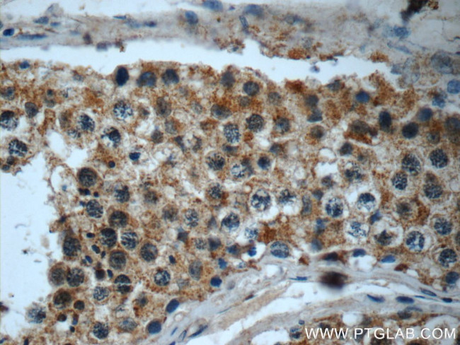 LY6H Antibody in Immunohistochemistry (Paraffin) (IHC (P))