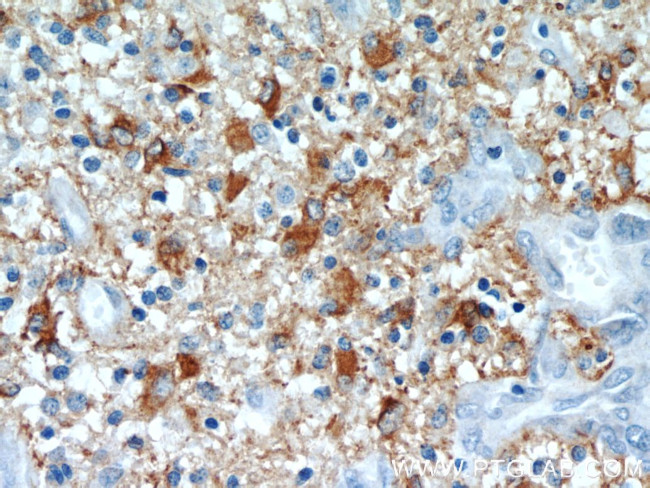 GFAP Antibody in Immunohistochemistry (Paraffin) (IHC (P))