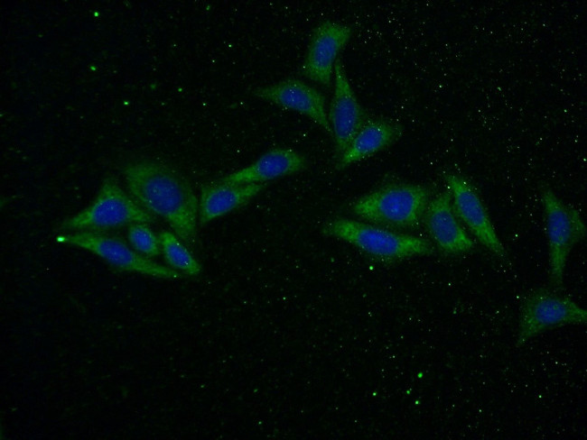 CTGF Antibody in Immunocytochemistry (ICC/IF)