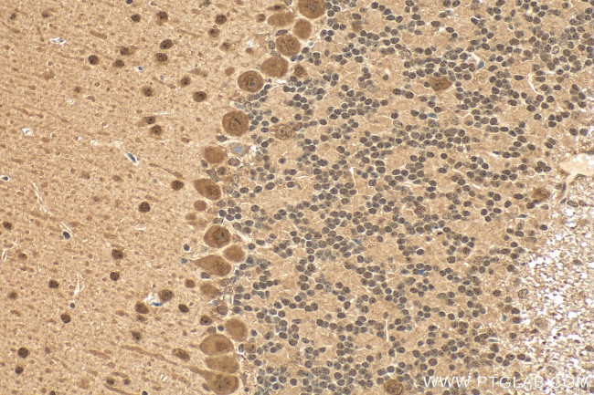 ACIN1 Antibody in Immunohistochemistry (Paraffin) (IHC (P))