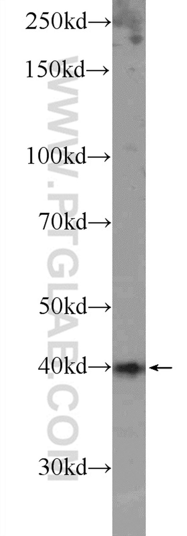 SOX12 Antibody in Western Blot (WB)