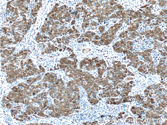 MTTP/MTP Antibody in Immunohistochemistry (Paraffin) (IHC (P))