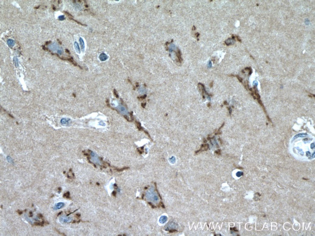 FRMPD4 Antibody in Immunohistochemistry (Paraffin) (IHC (P))