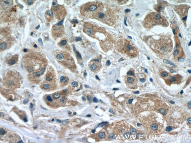 HEATR4 Antibody in Immunohistochemistry (Paraffin) (IHC (P))