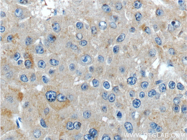 IGHMBP2 Antibody in Immunohistochemistry (Paraffin) (IHC (P))