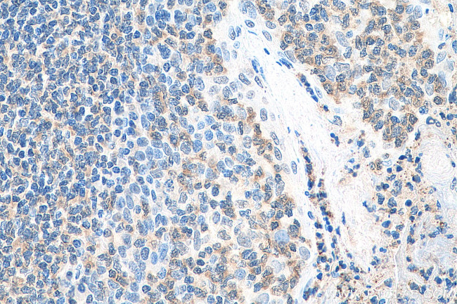 MAP4K1 Antibody in Immunohistochemistry (Paraffin) (IHC (P))