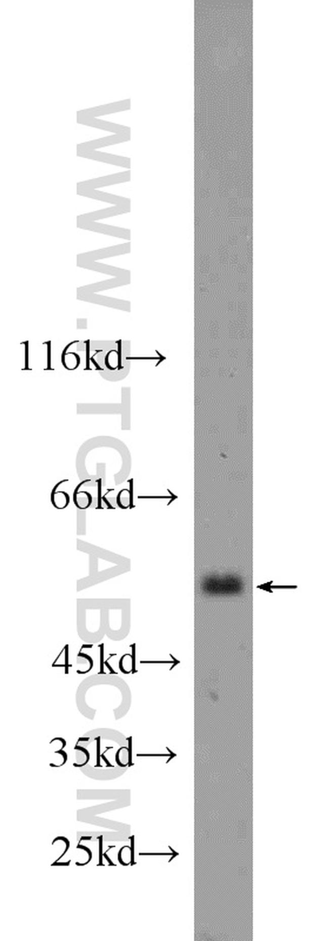 CLEC14A Antibody in Western Blot (WB)