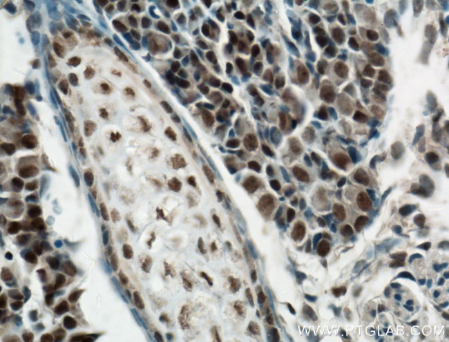 RCOR2 Antibody in Immunohistochemistry (Paraffin) (IHC (P))