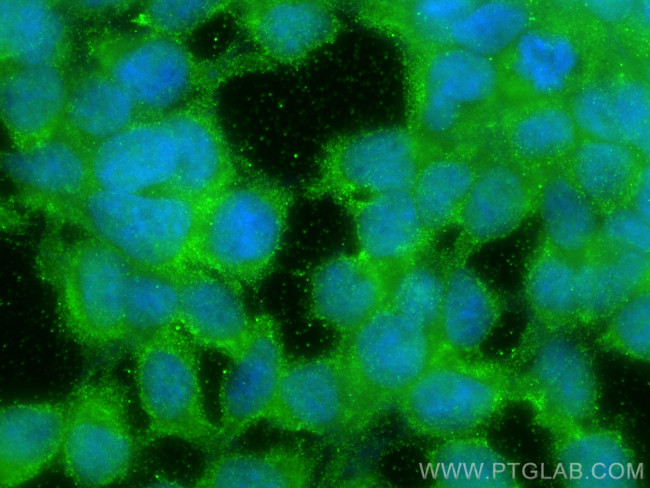 BCL2L15 Antibody in Immunocytochemistry (ICC/IF)