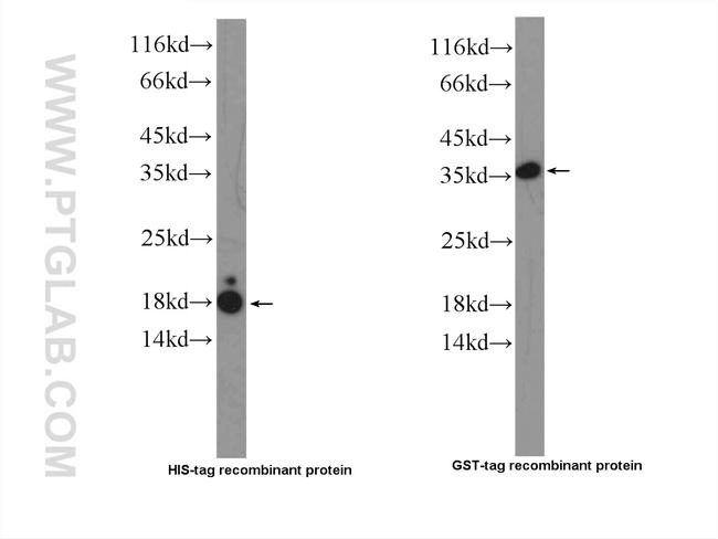 GR repeat Antibody in Western Blot (WB)