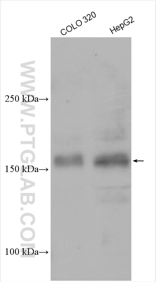 UTX Antibody in Western Blot (WB)