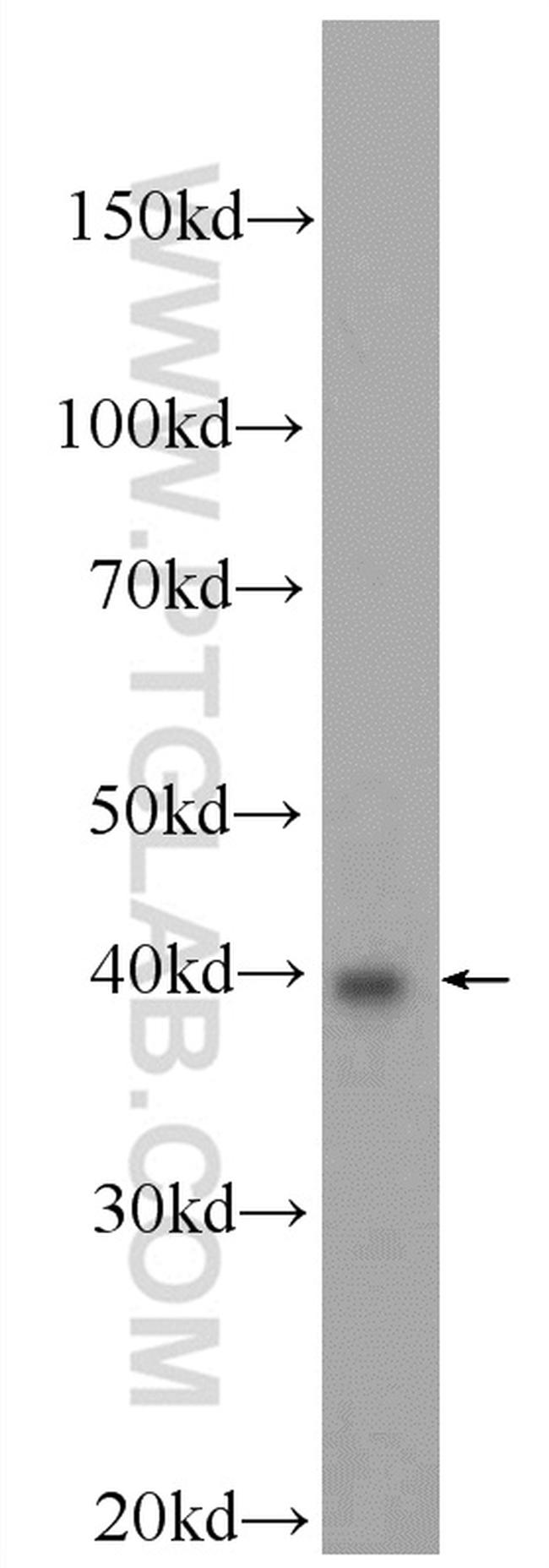 BRMS1L Antibody in Western Blot (WB)