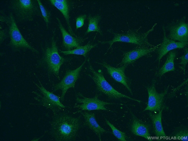ATPBD4 Antibody in Immunocytochemistry (ICC/IF)