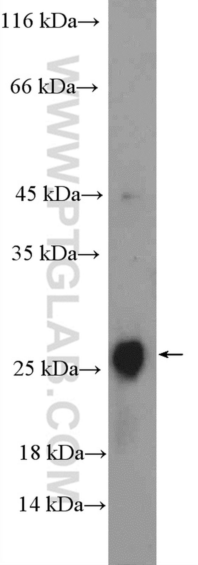 CLRN2 Antibody in Western Blot (WB)