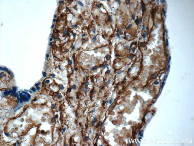 AMPD3 Antibody in Immunohistochemistry (Paraffin) (IHC (P))