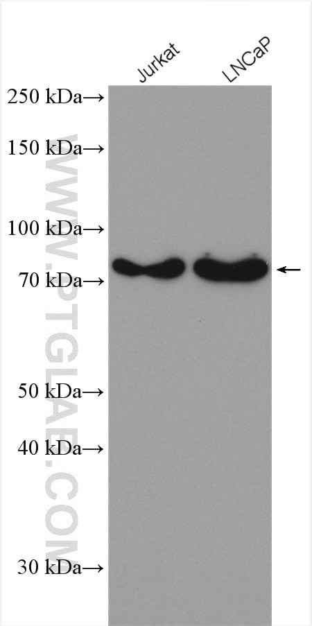 ANKRD13A Antibody in Western Blot (WB)