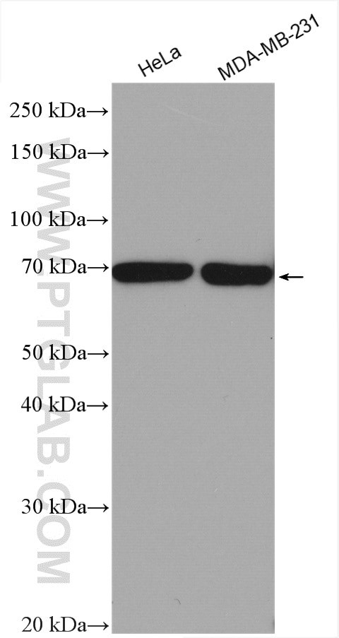 ANKRD13C Antibody in Western Blot (WB)