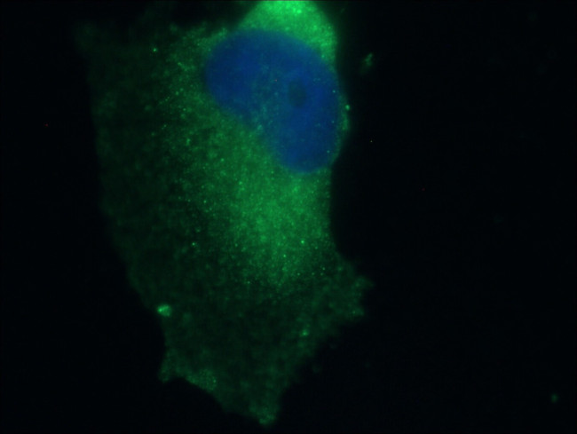 CEP89 Antibody in Immunocytochemistry (ICC/IF)
