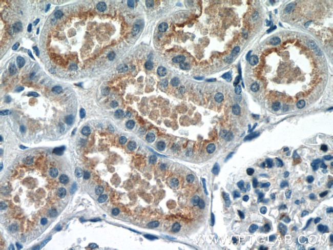 GPR108 Antibody in Immunohistochemistry (Paraffin) (IHC (P))