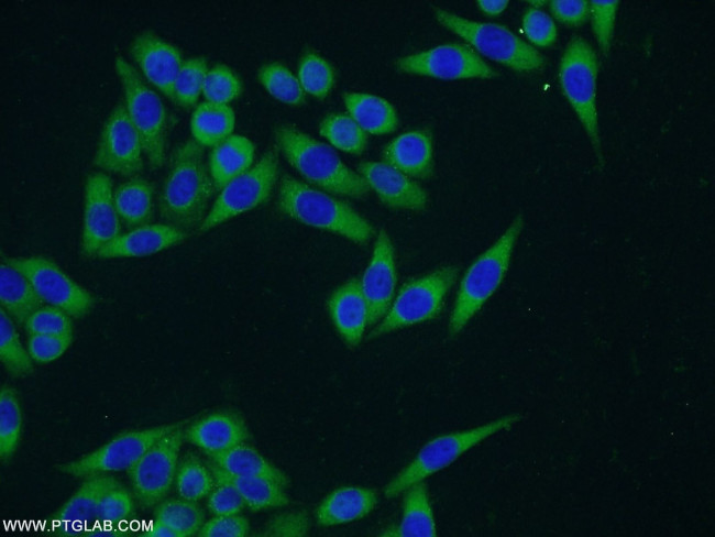 CCDC105 Antibody in Immunocytochemistry (ICC/IF)