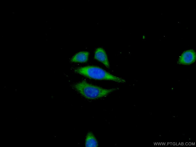 ANKRD39 Antibody in Immunocytochemistry (ICC/IF)