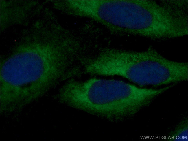 ARMC7 Antibody in Immunocytochemistry (ICC/IF)