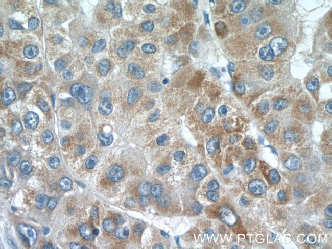 CMC1 Antibody in Immunohistochemistry (Paraffin) (IHC (P))
